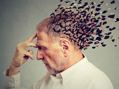 Alzheimer
