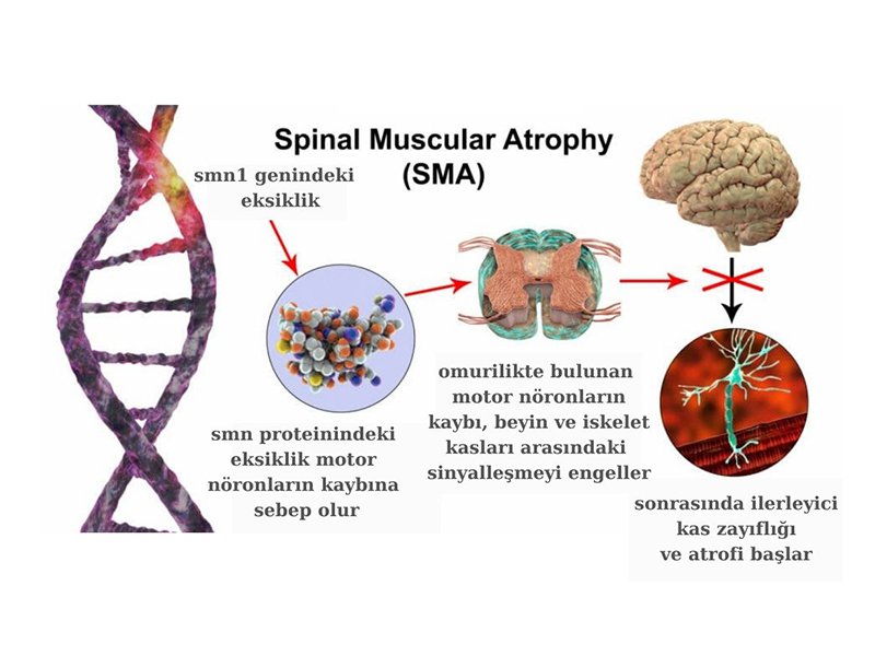 SMA (Spinal Muskuler Atrofi) Nedir?