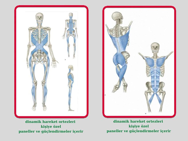 Dinamik Hareket Ortezi Nedir?