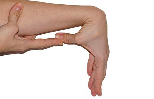 Ehlers – Danlos Sendromu