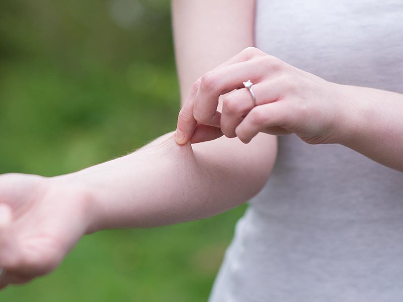 Ehlers – Danlos Sendromu