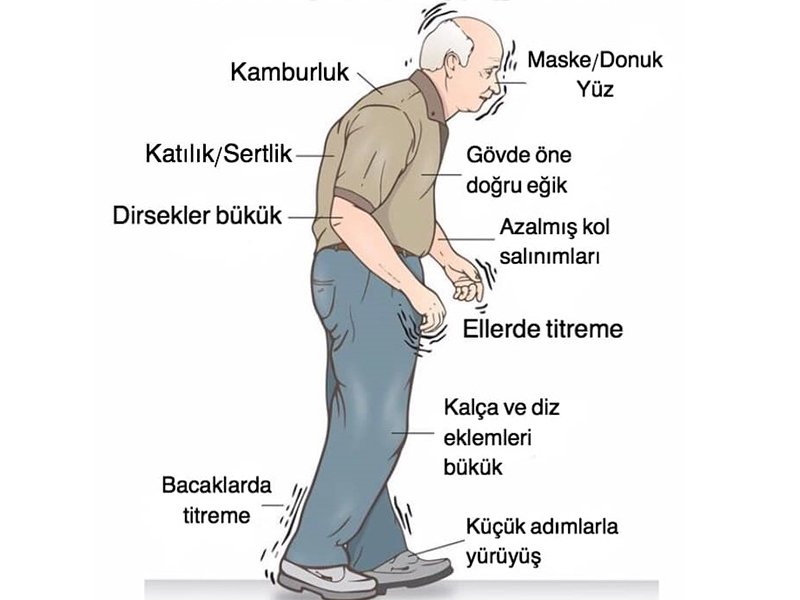Parkinson Hastalığı